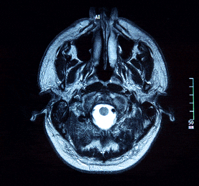 Brain GIF